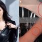 Xôn xao loạt vết sẹo trên cổ tay Dương Mịch, nghi vấn tự cắt cổ tay, ngược đãi bản thân