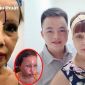 Hậu 'trùng tu nhan sắc', cô dâu 63 tuổi ở Cao Bằng gặp biến chứng phẫu thuật nặng nề