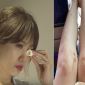 Khán giả xót xa khi nhìn thấy hình ảnh Hari Won chằng chịt vết bầm tím trên cơ thể