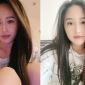 Bạn bè sốt sắng hỏi han khi Mai Phương Thúy bị chấn thương và phải trải qua ngày bi quan cùng cực