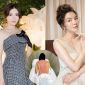 Lý Nhã Kỳ đăng ảnh lưng trần chằng chịt vết đỏ khiến bạn bè và khán giả vô cùng lo lắng