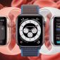 Phiên bản Apple Watch dành cho VĐV thể thao sẽ có màn hình lớn, vỏ kim loại và thời lượng pin lớn
