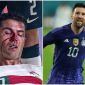 Tin MU hôm nay: Chị gái Ronaldo bị đồng đội của Messi chỉ trích sau khi lên tiếng bênh vực em trai