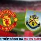 Xem trực tiếp bóng đá MU vs Burnley ở đâu, kênh nào?; Link xem trực tiếp Cúp Liên đoàn Anh FullHD