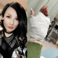 Trizzie Phương Trinh nói về những đau đớn vừa trải qua khi đi cắt chỉ vết thương: ‘Thốn đến xương’
