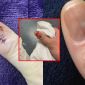 Thợ nail cứu sống 1 cô gái khi phát hiện vệt bầm trên móng tay, sửng sốt khi nhận kết quả chuẩn đoán