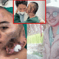 Cú lột xác ngoạn mục về diện mạo của cô gái 31 tuổi có khối u khổng lồ trên đầu ở Ninh Thuận