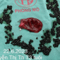 Hà Nội: Đau bụng trong thời gian dài, bà cụ 73 tuổi nhập viện phát hiện có hàng nhìn viên sỏi mật