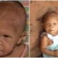 Bí ẩn về cô gái 40 tuổi nhưng sống trong hình hài 1 đứa trẻ sơ sinh, khoa học chưa thể giải thích