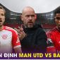 Nhận định bóng đá MU vs Bayern Munich - Champions League: HLV Ten Hag chính thức bị sa thải?