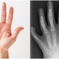 Tại sao con người có 5 ngón tay, ngón chân mà không phải 6 hay 7 ngón?