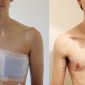 Người chuyển giới dùng testosterone có khả năng mang thai không?
