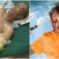 Hậu quả kinh hoàng của việc bị điện giật, khiến ai cũng ớn lạnh sống lưng