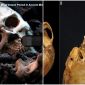 Hé lộ về 1 vật thể bất thường 'độc nhất vô nhị' trong hộp sọ từ thế kỉ 18