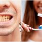 2 lỗi đánh răng phổ biến khiến răng bị ố vàng không phải ai cũng biết