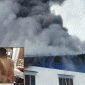 Tình hình sức khỏe hiện tại của nam công nhân bị bỏng nặng toàn thân trong vụ cháy lớn ở Đồng Nai