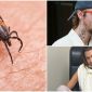 Justin Bieber, Bella Hadid và loạt ngôi sao đình đám mắc bệnh Lyme khó chữa do ve truyền