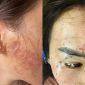 Chấn động vụ bắt cóc đánh ghen, tạt axit và xăm lên mặt ‘tình địch’ ở Cà Mau, công an vào cuộc