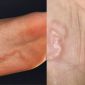Sở thích ăn đồ sống có thể khiến bạn nhiễm giun rồng mà không hề hay biết