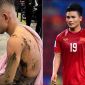 Trước thềm đấu ĐT Việt Nam, 'Ronaldo Malaysia' tái xuất với diện mạo khó tin sau khi bị tạt axit