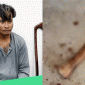 An Giang: Nam thanh niên chém chết 1 phụ nữ và khiến 1 cụ ông nguy kịch vì chó chạy ra đường