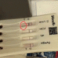 Vợ chồng trẻ sốc nặng khi phát hiện bộ xét nghiệm HIV dương tính trong túi đồ dùng khách sạn cao cấp