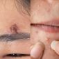 Cô gái ở Hà Nội suýt chết vì tự ý thói quen tưởng chừng vô hại, bác sĩ cảnh báo hậu quả khôn lường 