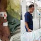 Người đàn ông Hưng Yên suýt tử vong sau khi chế biến thịt lợn sống: Bác sĩ cảnh báo hiểm họa từ liên cầu khuẩn lợn