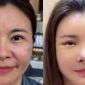 Diễn viên Kim Oanh gây tranh cãi với diện mạo mới sau ca ‘dao kéo’ toàn mặt: Chính chủ lên tiếng đáp trả