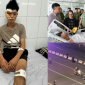 Lời khai không thể chấp nhận của 2 quái xế, người cầm lái nói lý do đâm chiến sĩ CSCĐ trọng thương