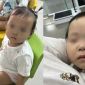 Tình hình sức khoẻ bé gái 1 tuổi tím tái mặt mũi sau buổi đầu đến lớp ở Bắc Ninh: Cơ quan chức năng nói gì?