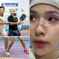 Hot girl pickleball khóc thét khi bị đối thủ nam đánh bóng vào mắt, CĐM bùng nổ tranh cãi