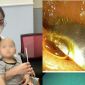 Hà Nội: Nuốt phải điếu thuốc lá chứa kim loại, bé 10 tháng tuổi suýt rơi vào 'án tử'