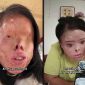 Bị chồng cũ tạt axit mù mắt: Người phụ nữ gây sốc khi tự ‘vẽ’ lại dung nhan để đổi đời