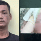 Vụ bé trai 2 tuổi bị mẹ ruột và người tình đánh đến nguy kịch: Cả hai phải đối mặt với tội danh nào?