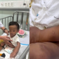 Hoàn cảnh éo le, không nơi nương tựa của bé trai 2 tuổi bị mẹ ruột và người tình bạo hành ở TP.HCM