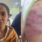Mẹ ruột cùng cha dượng đánh bé trai 2 tuổi phải nhập viện ở TP.HCM: Lời khai 'lỡ tay' gây tranh cãi