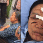 Trách nhiệm pháp lý vụ người phụ nữ bán rau bị xịt nước áp lực cao dẫn đến chảy máu mắt gây bức xúc