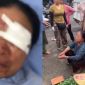 Camera ghi lại nguồn cơn vụ người phụ nữ bán rau bị xịt nước đến chảy máu mặt, tình hình đáng lo của nạn nhân