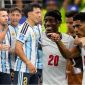 ĐT Anh hưởng lợi thế lớn từ FIFA trước trận đấu với Argentina, Messi và đồng đội ‘nhức đầu’