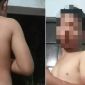 Đắk Lắk: Mẹ ruột thừa nhận tạt nước sôi vào người con, kể lại lý do từ chuyện rất nhỏ nhặt