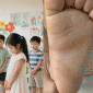Cô giáo bị tố đánh bé 3 tuổi đau nhiều ngày, phải đi tập tễnh: Cô giáo đã thừa nhận, gia đình thông tin nóng