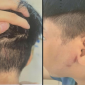 Bé trai 8 tuổi bị cha ruột đánh đến nhập viện: Bà ngoại kể lại cảnh tượng sau cuộc gọi cầu cứu